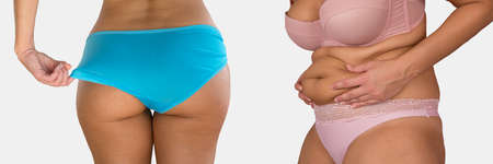 Overweight diet progress, close-up woman on white background.の写真素材