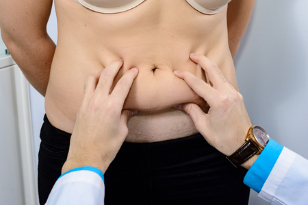 Hands of the doctor close-up on the stomach of the patient performing palpation before liposuctionの写真素材
