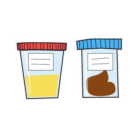 Set of popular medical tests: urine and fecal analysis. Cartoon style. Vector illustration of containers for analysis isolated on white background.のイラスト素材