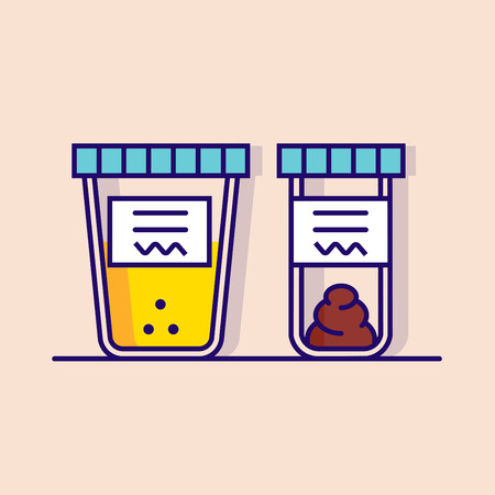 Set of popular medical tests: urine and fecal analysis. Cartoon style. Vector illustration of containers for analysis isolated on white background.のイラスト素材