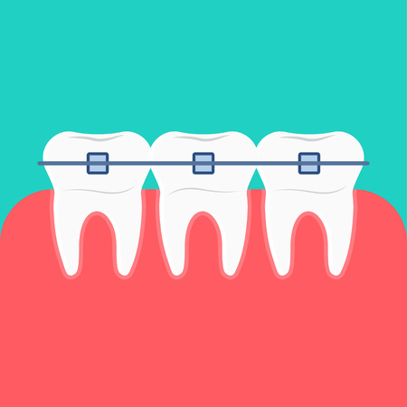 Teeth with dental braces icon. Dental concept, vector illustration.のイラスト素材