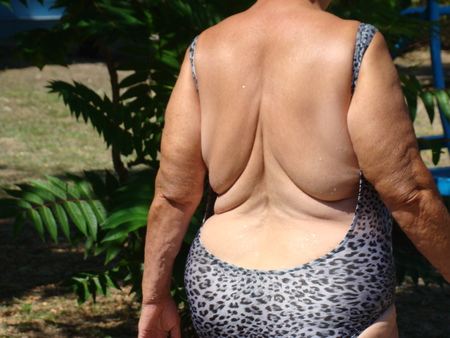 cellulite,obesity of the body from improper diet.の写真素材