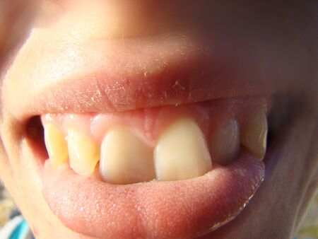 lips of a woman posing close up in front of the cameraの写真素材