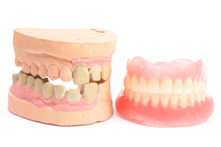 Denture isolated on white