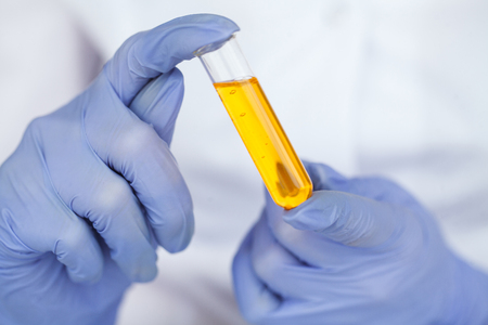 Biological test. Woman holding flask in lab. The scientist,dermatologist testing the organic natural product in the laboratoryの写真素材