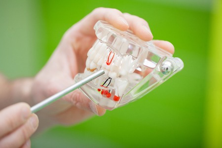 Dentist hand holding of jaw model of teeth and cleaning dental with dental tool.