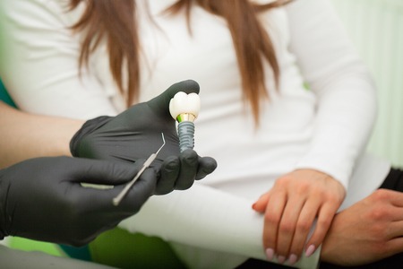 Dentist explaining teeth model to female patient. Technical shots on a dental prothetic laboratoryの写真素材