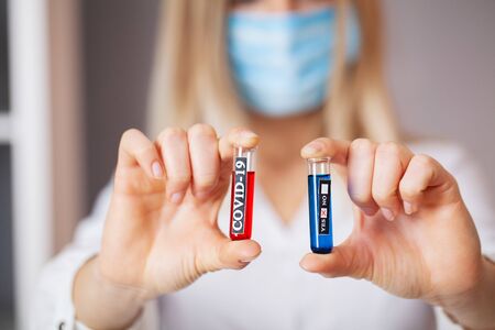 Health worker holds a test tube with a test of covid-2019
