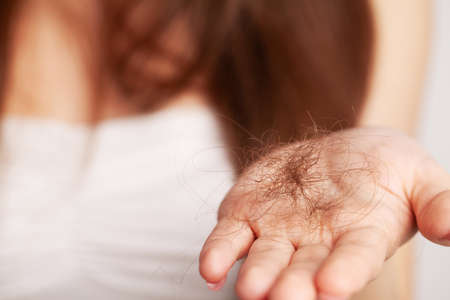 Young woman with comb worried about hair lossの写真素材