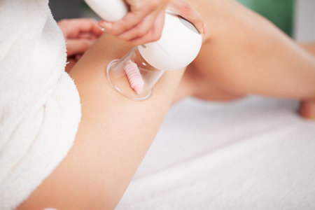 Anti-cellulite massage of the hips with the use of vacuum cans.の写真素材
