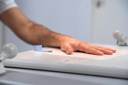 Close up of a hand x ray in sessionの写真素材