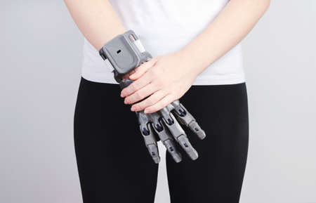 The girl with a prosthesis folded her hands on her belt.の写真素材