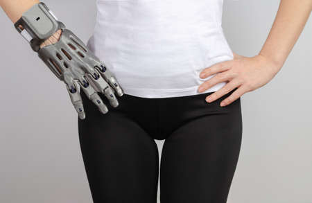 A girl with a prosthesis holds her hands on her belt.の写真素材