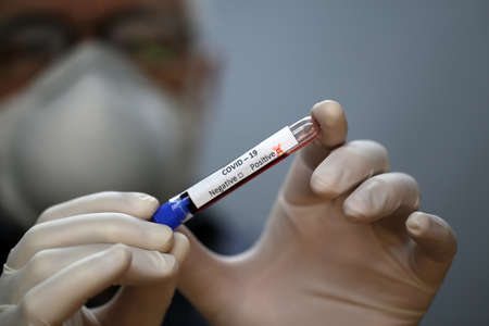 Coronavirus testing. A hand holds a test tube containing a patients sample that has tested positive...