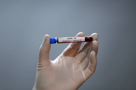Coronavirus testing. A hand holds a test tube containing a patients sample that has tested positive...