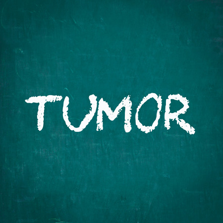 TUMOR written on chalkboardの写真素材