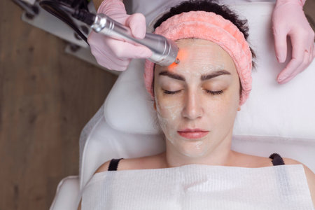 Cosmetologist making biolifting rf-lifting procedure. Rejuvenating skin, preventing aging, woman getting stimulating beauty facial treatment. hardware cosmetology in modern clinic. 4 k videoの写真素材