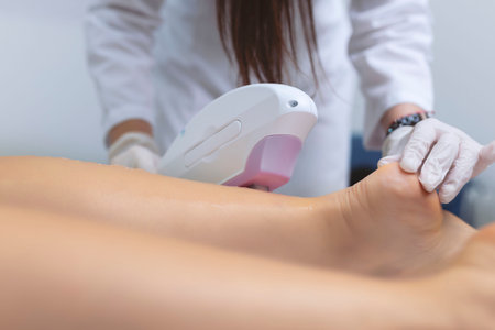 Beautician removes hair on beautiful female legs using a laser.の写真素材