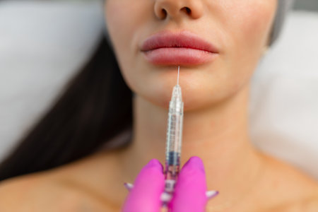 Injection procedure for lip augmentation, close-up. The cosmetologist slowly and carefully injects filler into the client lips. Advertising concept for facial care, youth and beautyの写真素材