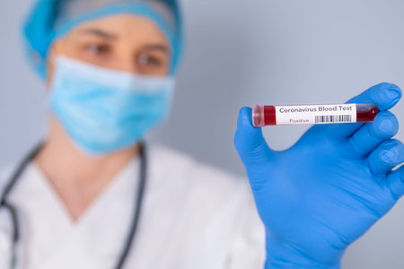 Nurse holding test tube with Positive Coronavirus test blood sample. Virus test and research...