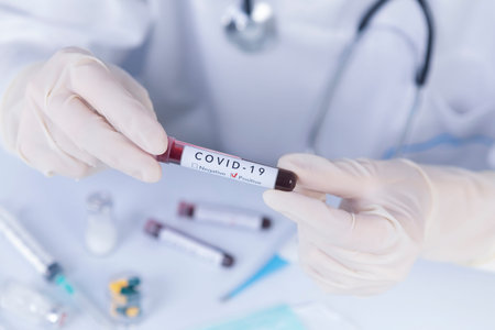 Doctor hands with protective gloves holding COVID 19 Coronavirus test blood. Virus test and research...