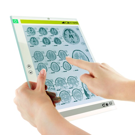 Futuristic glass digital tablet with brain medicine examinationの写真素材