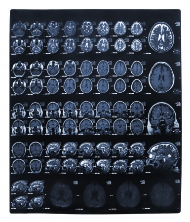 Imaging of the brain on x-rayの写真素材