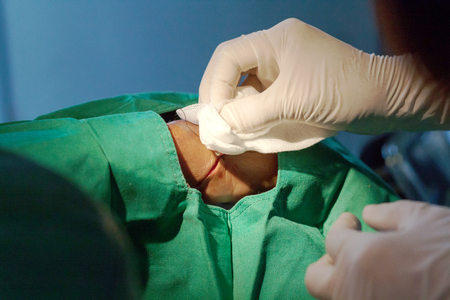Method bind thread while suturing woundの写真素材