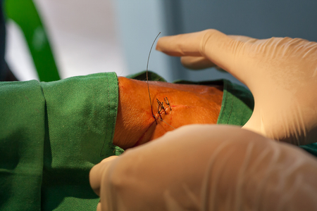 Method bind thread while suturing woundの写真素材