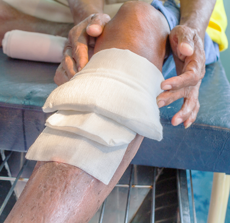 infected wound patient man legの写真素材