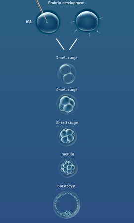 Embriogenesis embrio genesis . In vitro fertilization IVF . Artificial insemination. ICSI. Male infertility. Illustration for web or typography magazine, brochure, flyer, posterのイラスト素材