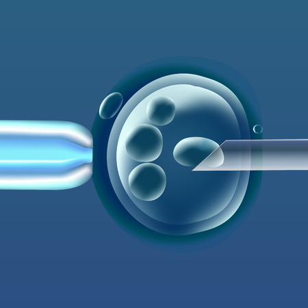 In vitro fertilization, the egg ovum , pipette and pipe horizontal, reproduction in humans illustration for an article, site or typography magazine, brochure, flyer, poster, blue color.のイラスト素材