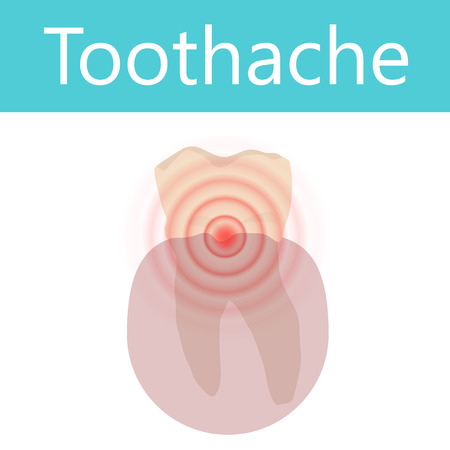 Toothache. Vector dental anatomy illustration. White background.のイラスト素材