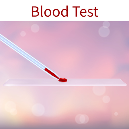 Blood test. Vector medical illustration. Droplet, capillary tube, slide. Pink abstract background.のイラスト素材