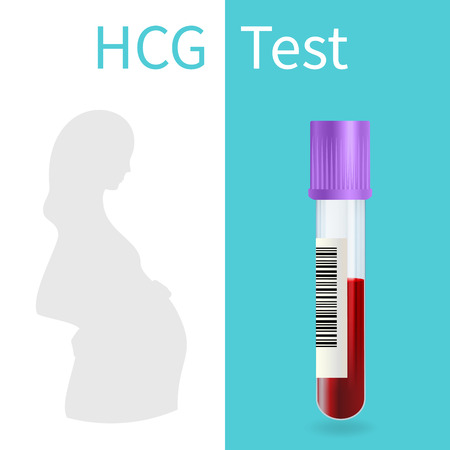 Blood pregnancy test. HCG. Vector medical illustration. White background.のイラスト素材