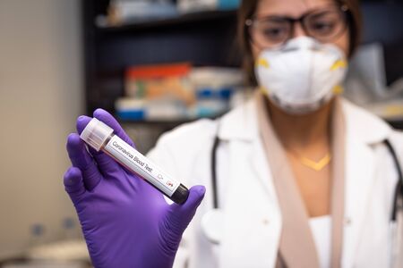 Doctor showing coronavirus positive blood sample in hospitalの写真素材