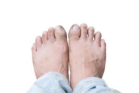 dirty foot isolate on white background