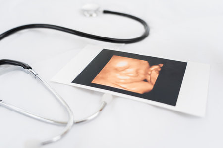 Picture of baby from ultrasound