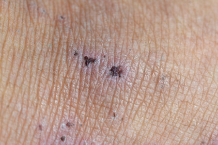 close up skin and scars on foot