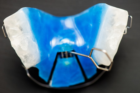 Dental Blue Removable Braces or Retainers for Teeth, shallow DOF, selective focus on the Key, Orthodontic on Dark Grey Backgroundの写真素材
