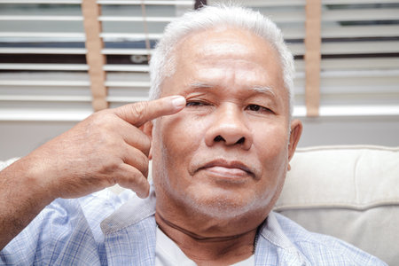 An elderly Asian man has eye irritation. Senior health care conceptの写真素材