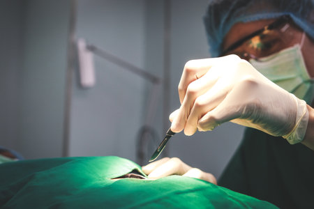 A surgeon or doctor in green uniform holding a scalpel performs an operation in a hospital. Emergency surgery. abdominal surgeryの写真素材