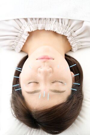 Up of a woman who is struck with acupuncture in the face in acupuncture clinicの写真素材