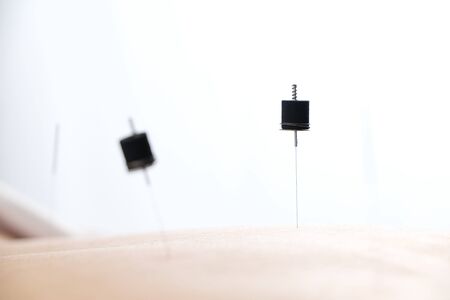 Woman stabbed in the back with needle in bright acupuncture clinicの写真素材