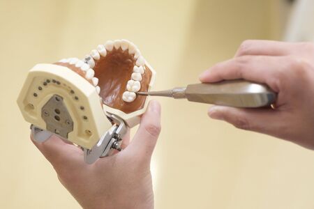 Tooth extraction image