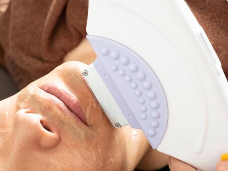 A man undergoing the treatment of beard hair removal of the jaw