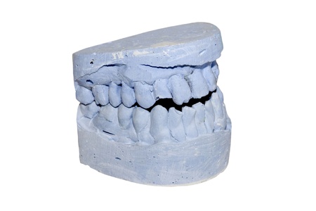 acrylic denture (False teeth) isolated on white
