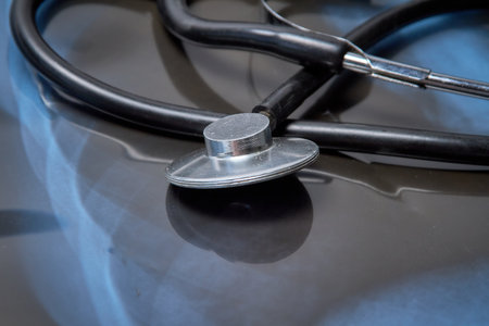 Medical stethoscope and X-ray of patient. medical examination.の写真素材