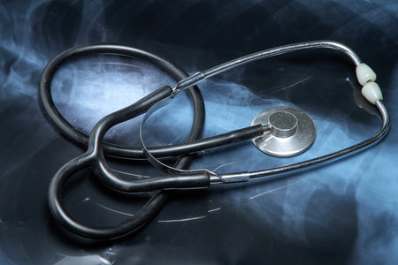 Medical stethoscope and X-ray of patient. medical examination.の写真素材