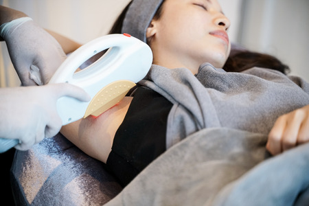 woman having underarm Laser hair removal epilation.の写真素材